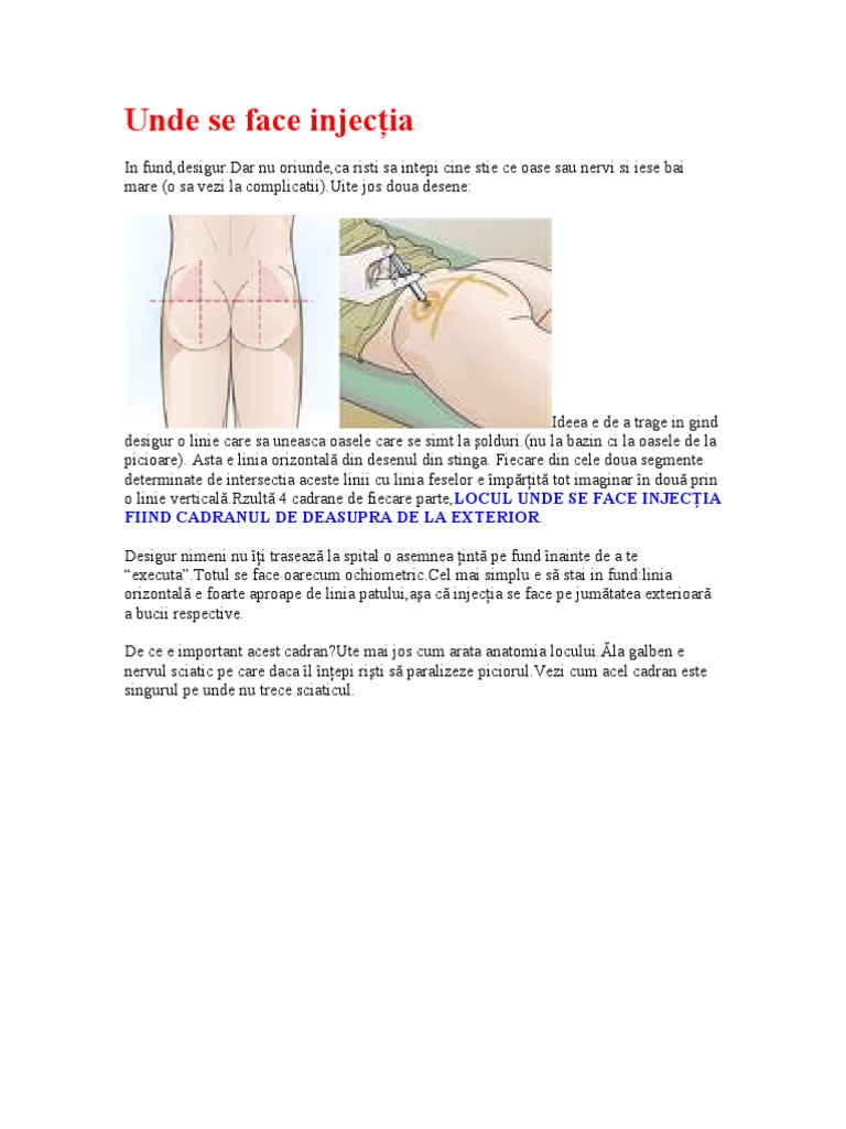 Injectia IM | PDF