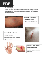 Wound #1: Open Wound - Punctured Wound: - Sharp Pointed Instrument