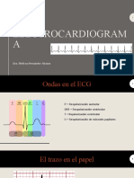 Electrocardiogram A: Dra. Melissa Hernández Alcaraz