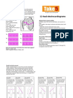 Take5 ECG