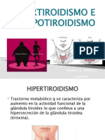 Causas, síntomas y tratamiento del hipertiroidismo e hipotiroidismo