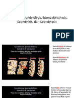 Perbedaan Spondylolysis, Spondylolisthesis, Spondylitis, dan Spondylosis.pptx