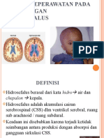 Asuhan Keperawatan Dengan Hidrosefalus