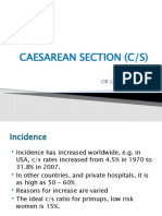 Caesarean Section (C/S) : by DR G. Saungweme