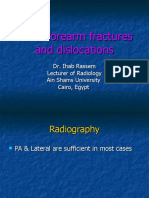 Distalforearmfracturesanddislocations.ppt