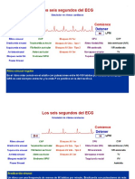 ALTERACIONES EN RESULTADOS EN EL EKG