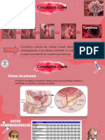 CANCER DE PROSTATA-editado PDF