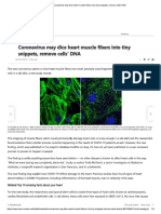 Coronovirus Dices Heart Muscle Fibers