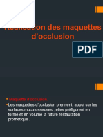 La Realisation de La Maquette D'occlusion ...