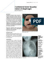 Case Report: Congenital Lower Lip Palsy and Diaphragmatic Eventration