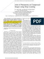 Automatic Detection of Pneumonia On Compressed Sensing Images Using Deep Learning