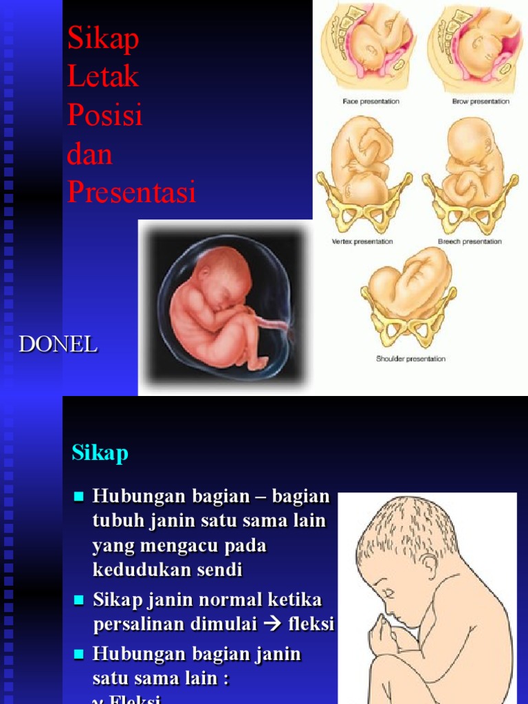 Sikap, Letak, Presentasi Dan Posisi Janin, Pengawasan Intrapartum Dan