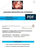 Anatomía Endoscópica Del Epitimpano
