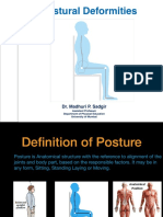 Understanding Postural Deformities Like Kyphosis