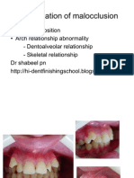 Download Classification of Malocclusion by Shabeel Pn SN47613919 doc pdf