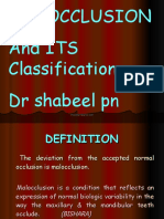 Malocclusion and Its Classification DR Shabeel PN