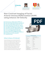 Case Study - AVM Facial Case With Inhance 3D Velocity