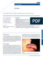 Cinnamon Contact Stomatitis: A Case Report and Review