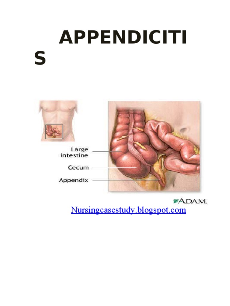 Case Study Appendectomy PDF Surgery Abdomen