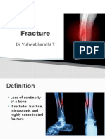 Fracture: DR Vishwabharathi T