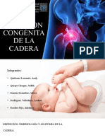 Luxación Congénita de La Cadera