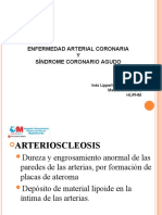 Enfermedad arterial coronaria y síndrome coronario agudo