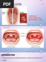 Acute Nasopharyngitis | PDF | Common Cold | Immunology