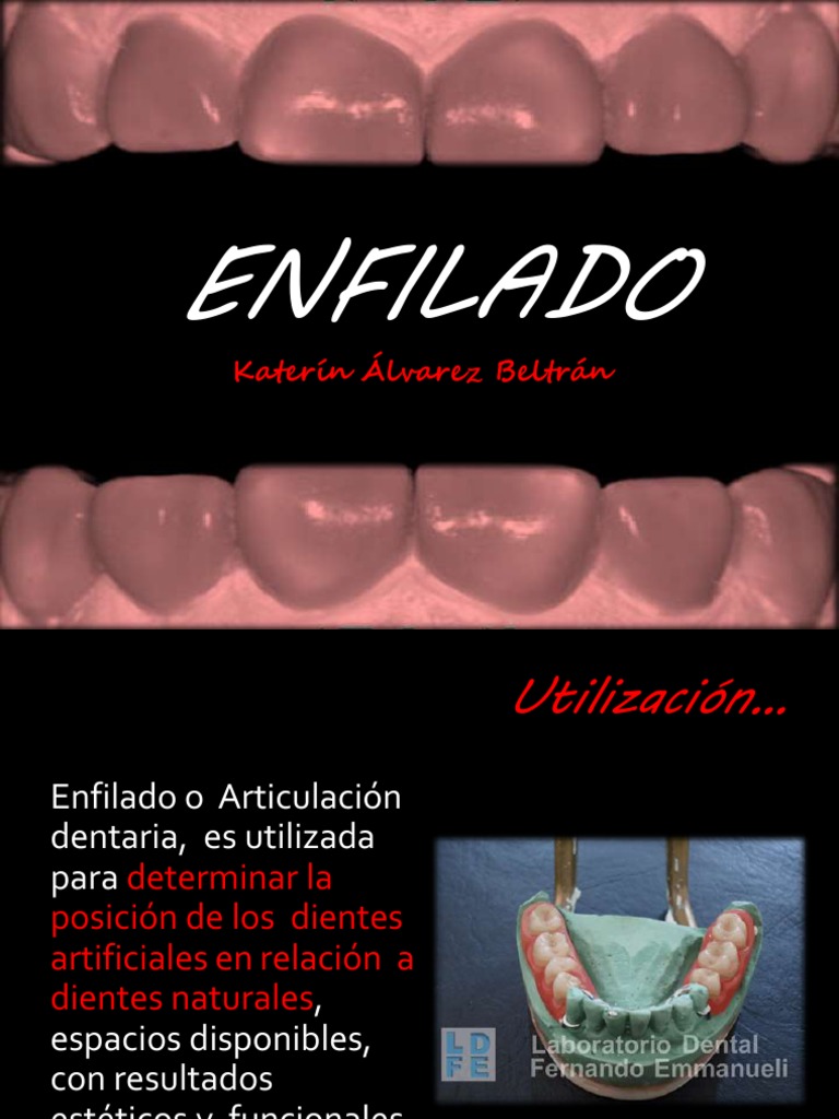 Enfilado de Dientes en Prótesis Total | PDF | Diente | Ramas de Odontología