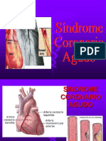 Síndrome Coronario Agudo