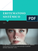 Lupus Eritematoso Sistémico