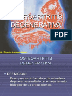 OSTEOARTRITIS DEGENERATIVA