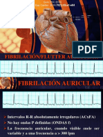 Fibrilación Auricular