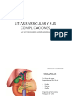 LITIASIS.pdf