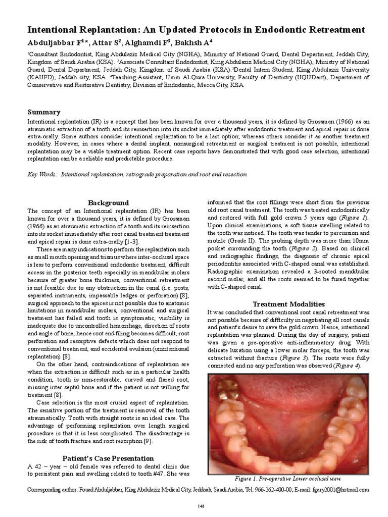Intentional Replantation An Updated Protocols in Endodontic