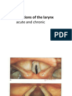 20 Inflammations of The Larynx