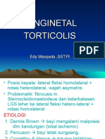 CONGINETAL TORTICOLIS