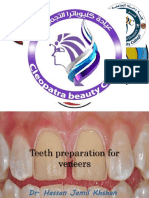 Teeth preparation for veneers Hassan.pdf