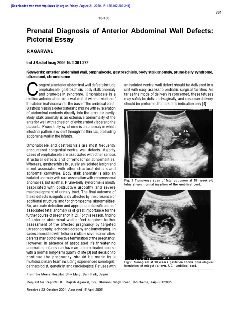 Prenatal Diagnosis of Anterior Abdominal Wall Defects: Pictorial Essay ...