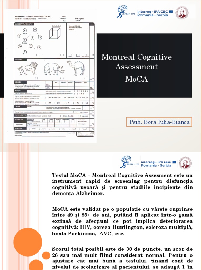 Bora MoCA | PDF