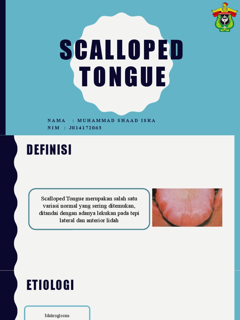 Scalloped Tongue PDF