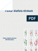 Felkar Diafízis-Törések