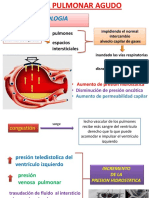 Fisiopatologia Edema Pulmonar Agudo