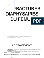 Fracture Diaphyse de Femur