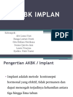 Akbk Implan