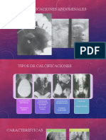 Calcificaciones Abdominales