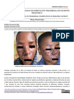 Herpes Zóster Pediátrico Trigeminal