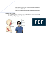 Nasogastric Tube Feeding