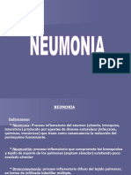 Neumonia