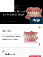 Tecnicas de Rebase en Protesis Total