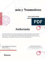 Atelectasia y Neumotorax